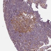 Anti-ATP8A1 antibody produced in rabbit Prestige Antibodies® Powered by Atlas Antibodies, affinity isolated antibody, buffered aqueous glycerol solution