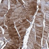 Anti-PLEC antibody produced in rabbit Prestige Antibodies® Powered by Atlas Antibodies, affinity isolated antibody, buffered aqueous glycerol solution, ab2