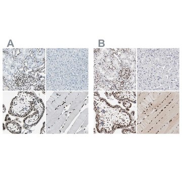 Anti-MEF2D antibody produced in rabbit Ab2, Prestige Antibodies&#174; Powered by Atlas Antibodies, affinity isolated antibody, buffered aqueous glycerol solution