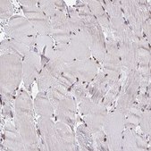 Anti-TRIP12 antibody produced in rabbit Prestige Antibodies® Powered by Atlas Antibodies, affinity isolated antibody, buffered aqueous glycerol solution