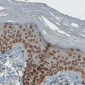 Monoclonal Anti-EMD antibody produced in mouse Prestige Antibodies® Powered by Atlas Antibodies, clone CL0203, purified immunoglobulin, buffered aqueous glycerol solution