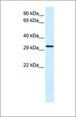 Anti-C21ORF2 antibody produced in rabbit affinity isolated antibody