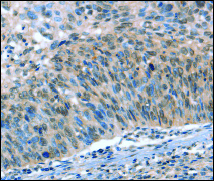 Anti-CAMTA1 antibody produced in rabbit affinity isolated antibody