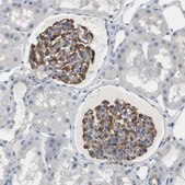 Anti-ADCY10 antibody produced in rabbit Prestige Antibodies® Powered by Atlas Antibodies, affinity isolated antibody, buffered aqueous glycerol solution
