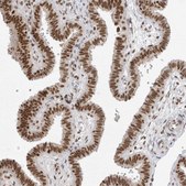 Anti-RPA2 antibody produced in rabbit Prestige Antibodies® Powered by Atlas Antibodies, affinity isolated antibody, buffered aqueous glycerol solution, ab2