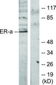 Anti-Estrogen Receptor-α antibody produced in rabbit affinity isolated antibody