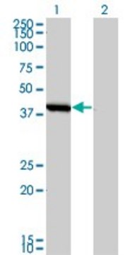 Monoclonal Anti-SMS antibody produced in mouse clone 1G6, purified immunoglobulin, buffered aqueous solution