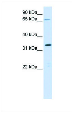 Anti-C19ORF47 antibody produced in rabbit affinity isolated antibody