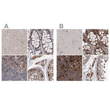 Anti-ASCC3 antibody produced in rabbit Prestige Antibodies&#174; Powered by Atlas Antibodies, affinity isolated antibody, buffered aqueous glycerol solution, ab1