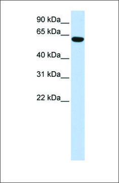 Anti-CCDC11 antibody produced in rabbit affinity isolated antibody