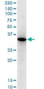 Monoclonal Anti-RARRES1, (C-terminal) antibody produced in mouse clone 2E2, purified immunoglobulin, buffered aqueous solution