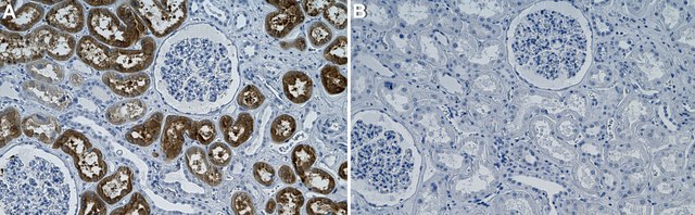 Anti-PAH Antibody, clone 1L14 ZooMAb&#174; Rabbit Monoclonal recombinant, expressed in HEK 293 cells