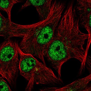 Anti-TDRD3 antibody produced in rabbit Prestige Antibodies&#174; Powered by Atlas Antibodies, affinity isolated antibody