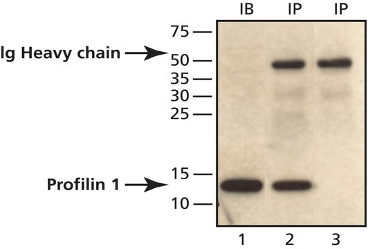 Anti-Profilin 1 (C-terminal) antibody produced in rabbit ~1&#160;mg/mL, affinity isolated antibody, buffered aqueous solution