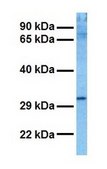 Anti-NMNAT1 IgG fraction of antiserum