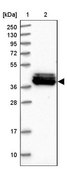Anti-MRPS31 antibody produced in rabbit Prestige Antibodies® Powered by Atlas Antibodies, affinity isolated antibody, buffered aqueous glycerol solution