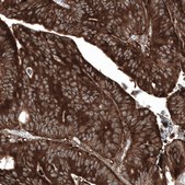 Anti-GSPT1 antibody produced in mouse Prestige Antibodies® Powered by Atlas Antibodies, clone CL13332, purified by using Protein A, buffered aqueous glycerol solution
