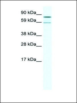 Anti-PARN antibody produced in rabbit IgG fraction of antiserum