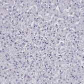 Anti-COL22A1 antibody produced in rabbit Prestige Antibodies® Powered by Atlas Antibodies, affinity isolated antibody, buffered aqueous glycerol solution