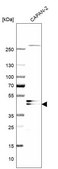 Anti-NCEH1 antibody produced in rabbit Prestige Antibodies® Powered by Atlas Antibodies, affinity isolated antibody, buffered aqueous glycerol solution