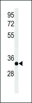 ANTI-ACER3 (C-TERM) antibody produced in rabbit IgG fraction of antiserum, buffered aqueous solution