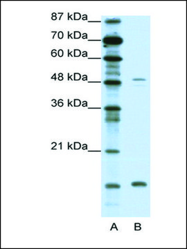 Anti-FBN1 antibody produced in rabbit affinity isolated antibody, lyophilized powder