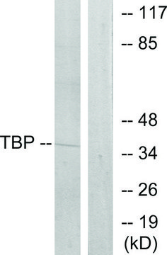 Anti-TBP antibody produced in rabbit affinity isolated antibody