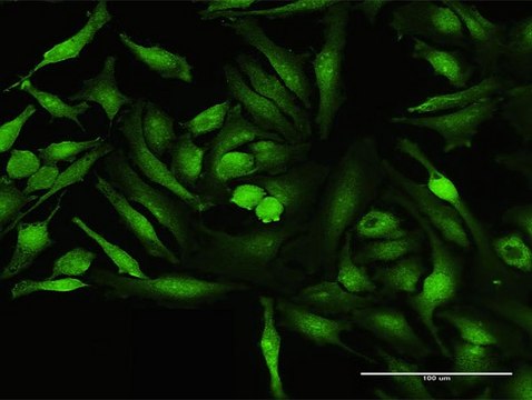 Anti-CALCOCO1 antibody produced in mouse purified immunoglobulin, buffered aqueous solution