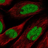 Anti-NOSIP antibody produced in rabbit Prestige Antibodies® Powered by Atlas Antibodies, affinity isolated antibody