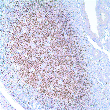 PAX-5 (24) Mouse Monoclonal Antibody