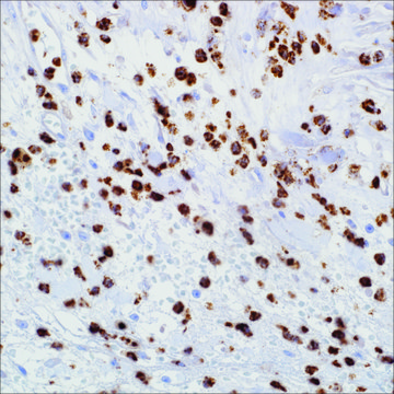 Myeloperoxidase (SP72) Rabbit Monoclonal Antibody