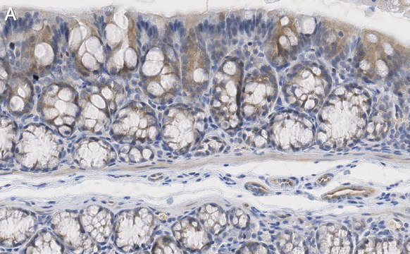 Anti-iNOS (NOSII) Antibody, clone 2G17 ZooMAb&#174; Rabbit Monoclonal recombinant, expressed in HEK 293 cells