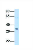 Anti-TP53 (ab3) antibody produced in rabbit affinity isolated antibody