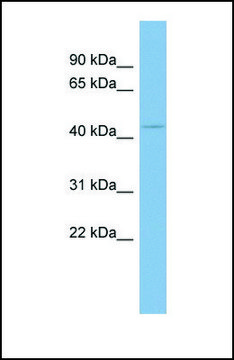 Anti-UGCG antibody produced in rabbit affinity isolated antibody