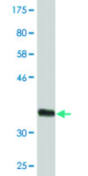 Monoclonal Anti-HSD3B2 antibody produced in mouse clone 1E8, purified immunoglobulin, buffered aqueous solution