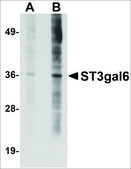 Anti-ST3GAL6 antibody produced in rabbit affinity isolated antibody, buffered aqueous solution