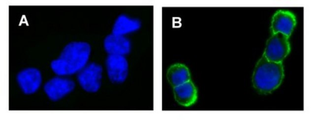 Anti-phospho-erbB-2/HER-2 (Tyr1248) Antibody, Alexa Fluor&#8482; 488 Upstate&#174;, from rabbit