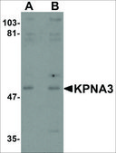 Anti-KPNA3 antibody produced in rabbit affinity isolated antibody, buffered aqueous solution