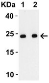 Anti-SARS-CoV-2 (COVID-19) Envelope antibody produced in rabbit affinity isolated antibody