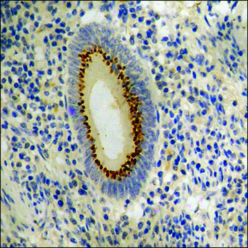 Anti-phospho-CDC25A (pSer124) antibody produced in rabbit affinity isolated antibody