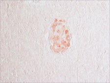 Anti-Glutamic Acid Decarboxylase 65 (5-22) antibody produced in rabbit IgG fraction of antiserum, buffered aqueous solution