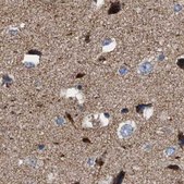 Anti-MECR antibody produced in rabbit Prestige Antibodies® Powered by Atlas Antibodies, affinity isolated antibody, buffered aqueous glycerol solution, Ab1