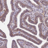Anti-TSPAN15 antibody produced in rabbit Prestige Antibodies® Powered by Atlas Antibodies, affinity isolated antibody, buffered aqueous glycerol solution