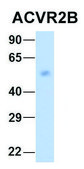 Anti-ACVR2B antibody produced in rabbit affinity isolated antibody
