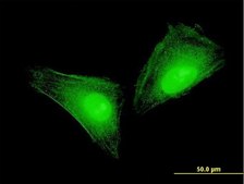 Monoclonal Anti-S100A11 antibody produced in mouse clone 2F4, purified immunoglobulin, buffered aqueous solution