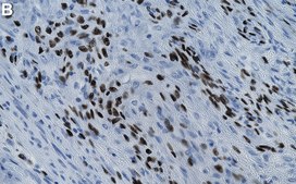 Anti-Histone H3.3 G34W Antibody, clone 2E20 ZooMAb® Rabbit Monoclonal recombinant, expressed in HEK 293 cells