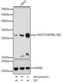 Anti-Phospho-HSP27/HSPB1-S82 antibody produced in rabbit