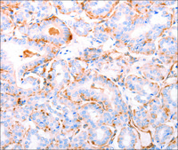 Anti-ABCA4 antibody produced in rabbit affinity isolated antibody