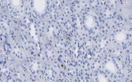 Anti-HNF-1β Antibody, clone 1M22 ZooMAb® Rabbit Monoclonal recombinant, expressed in HEK 293 cells