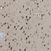 Anti-DNAJB11 antibody produced in rabbit Prestige Antibodies&#174; Powered by Atlas Antibodies, affinity isolated antibody, buffered aqueous glycerol solution